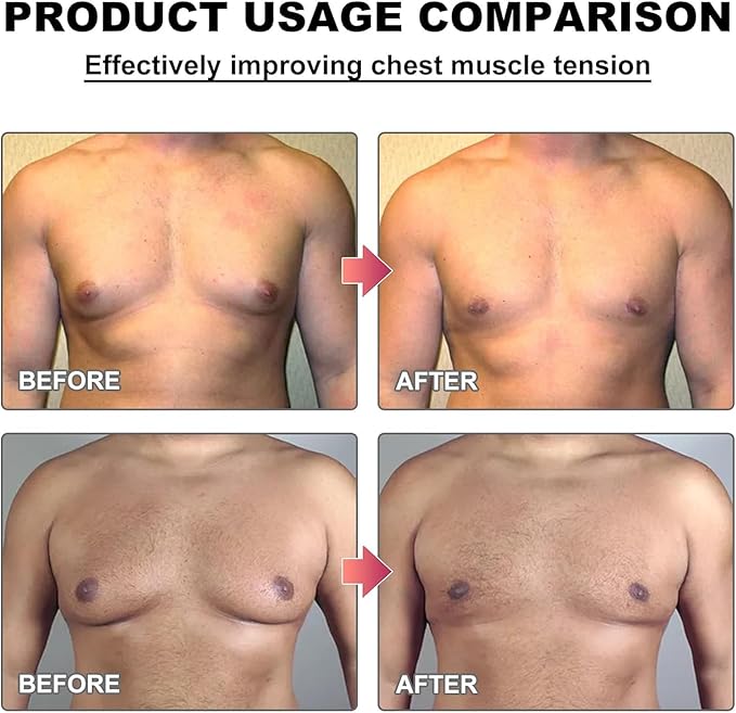 Men’s Chest Care Solution – Skin Elasticity & Health Enhancer